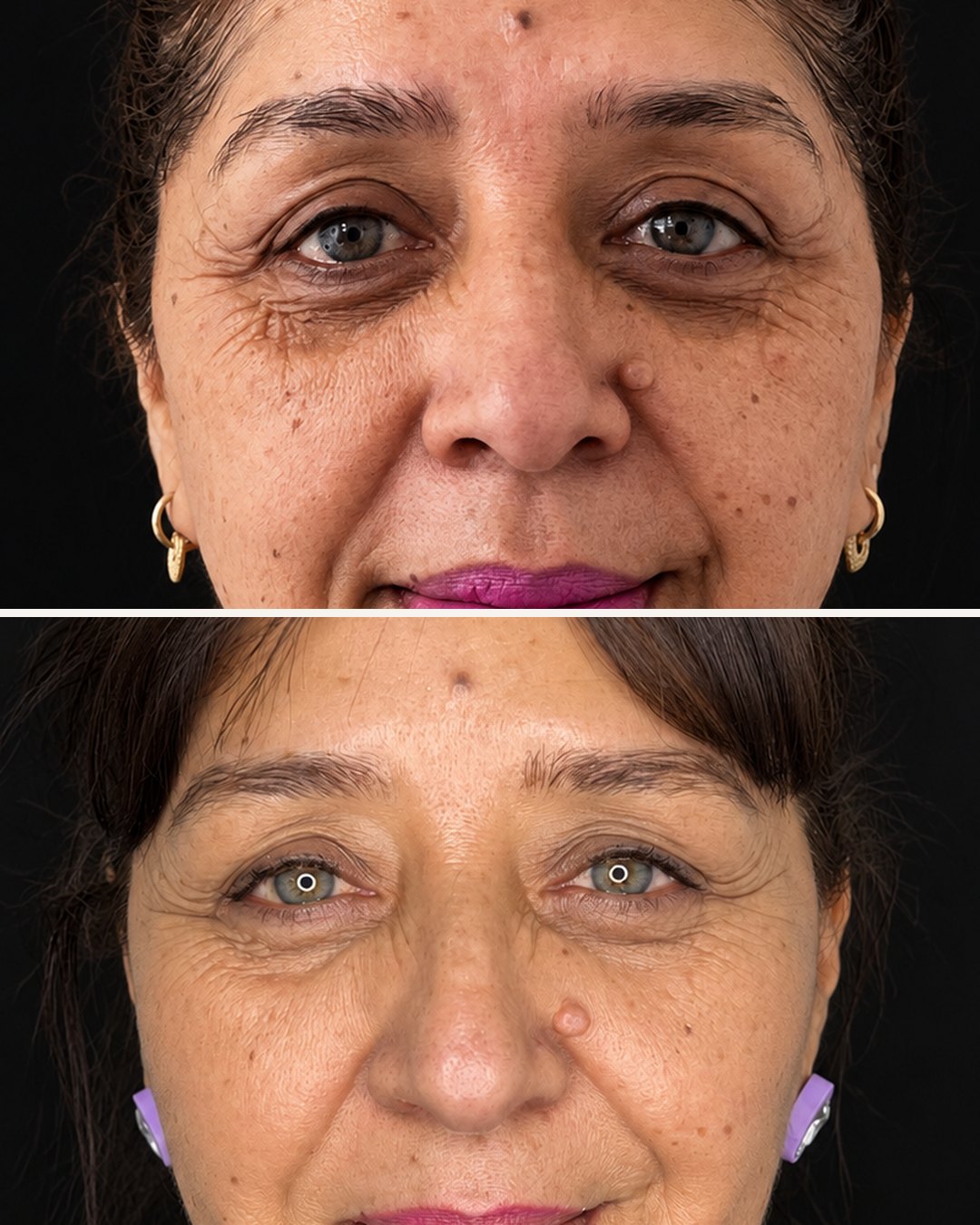 Detalle de la mirada antes y después